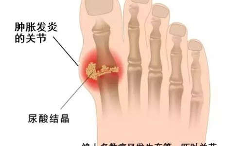 昏迷病人嘴巴往上噘-昏迷中的病人张嘴呼吸网—知名的昏迷病人喘气特别粗是要醒吗网站,分享昏迷病人嘴巴开始动了知识